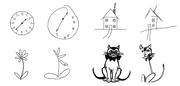 hemispatial-neglect-drawings