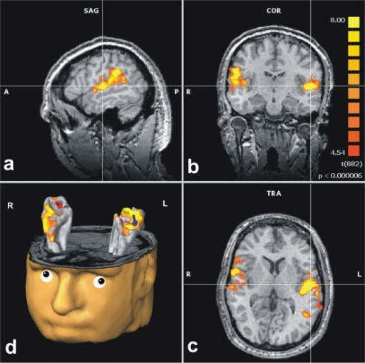auditory-cortex