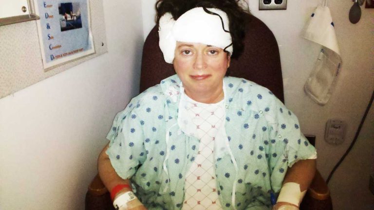 pamgilbert_aftersurgery