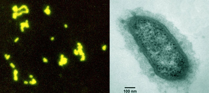 Methanobrevibacter-smithii