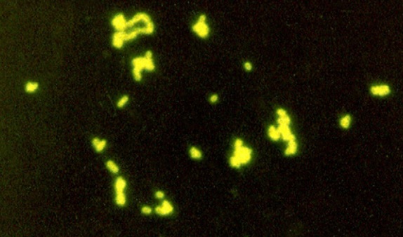 Methanobrevibacter smithii