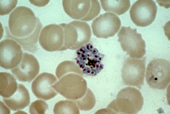 Plasmodium vivax mature schizont
