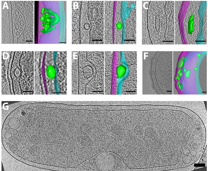 periplasmic vesicles
