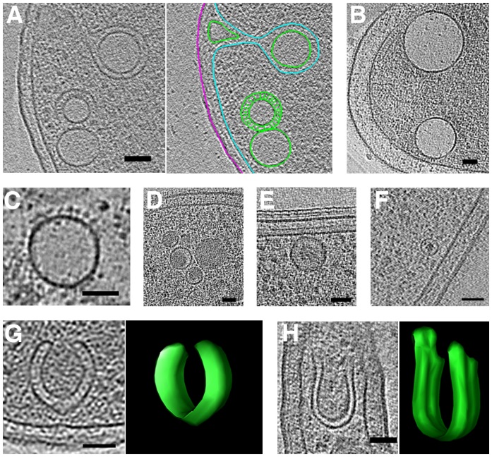 vesicles