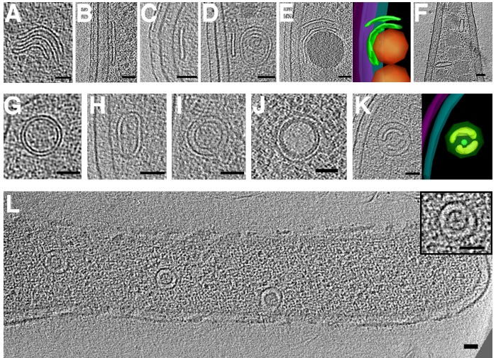 vesicles1